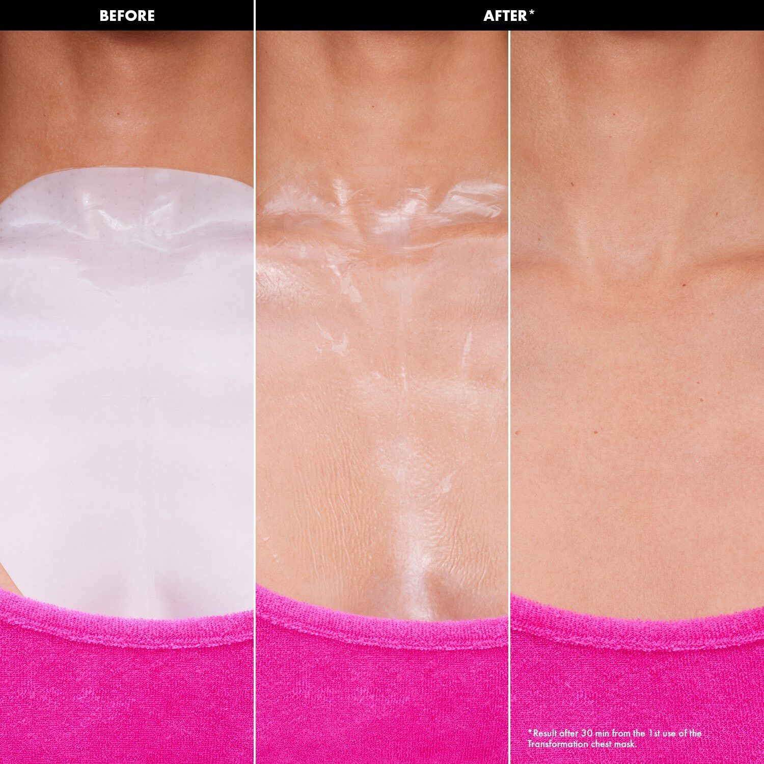 Transformation masks - Hydrogel ansigtsmasker
