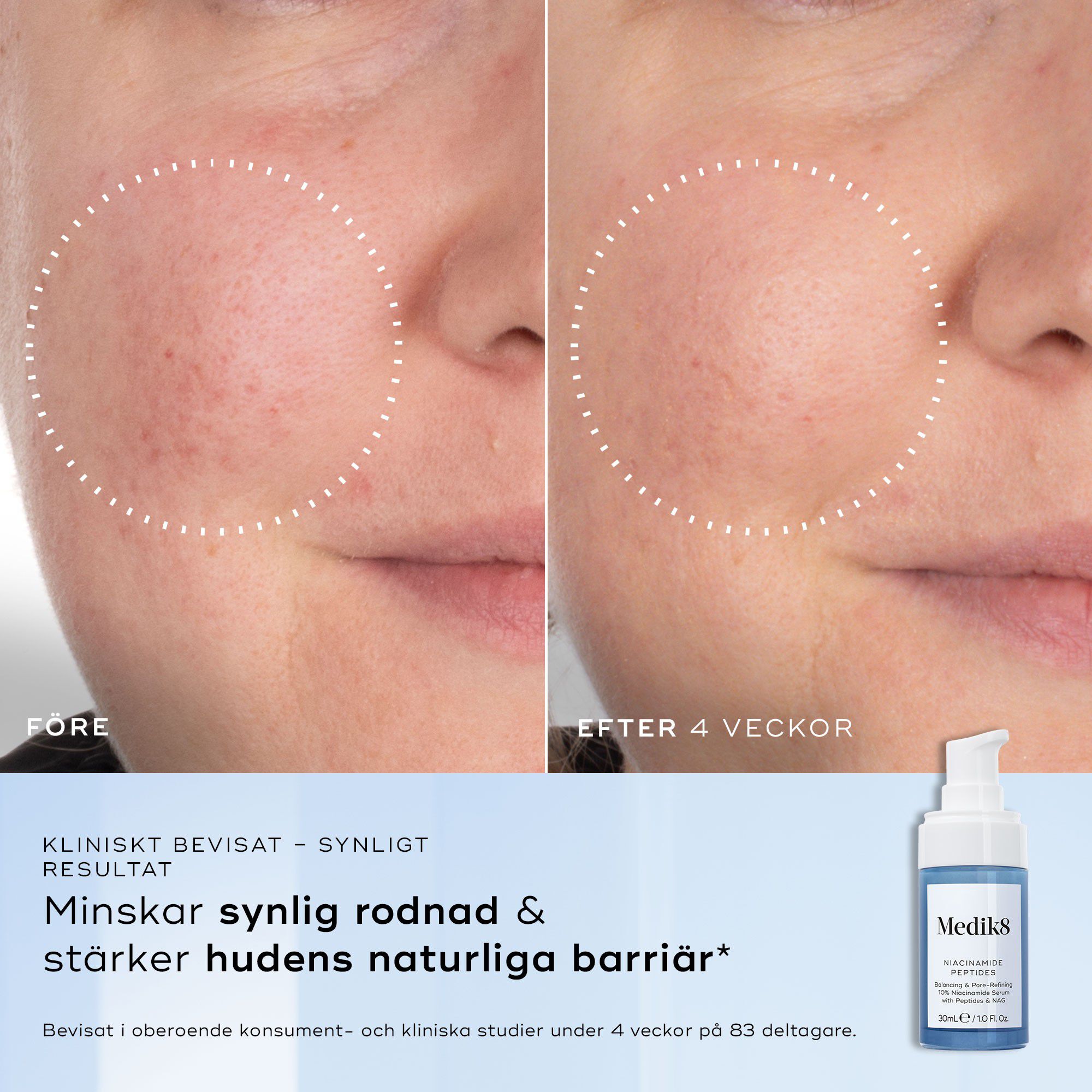 Niacinamide Peptides