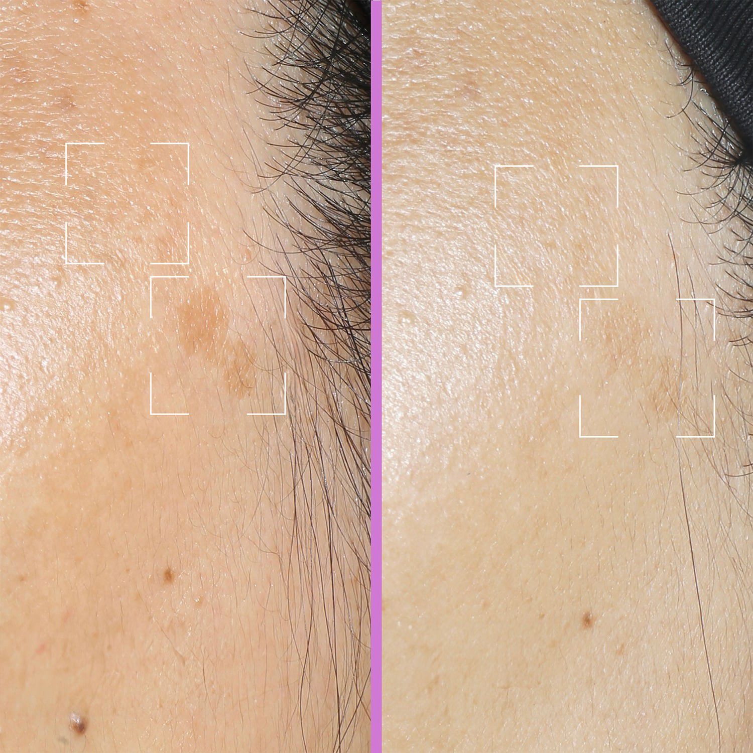 Spotless kapsler - Serum mod pletter beriget med niacinamid, C-vitamin