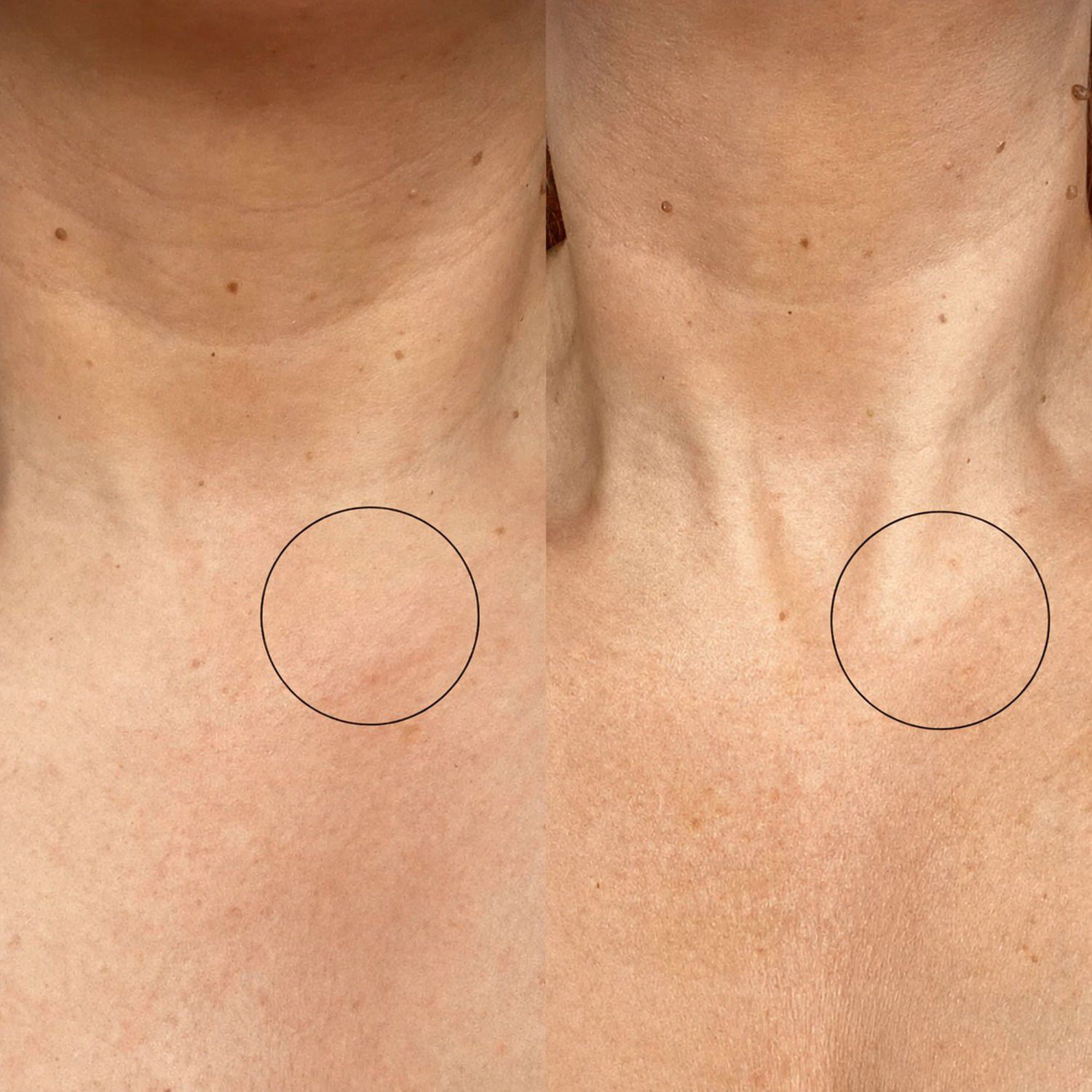 Bio-active Ceramide Neck Stick - Hals-stick med bio-aktiv ceramid