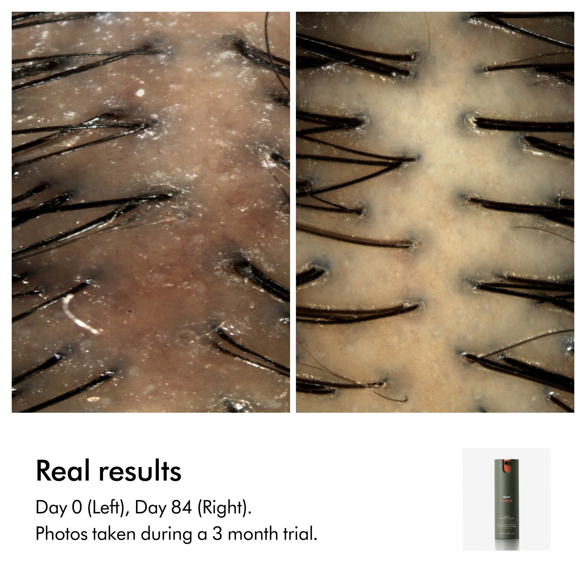 Dyson Amino leave-in scalp bubble treatment refill