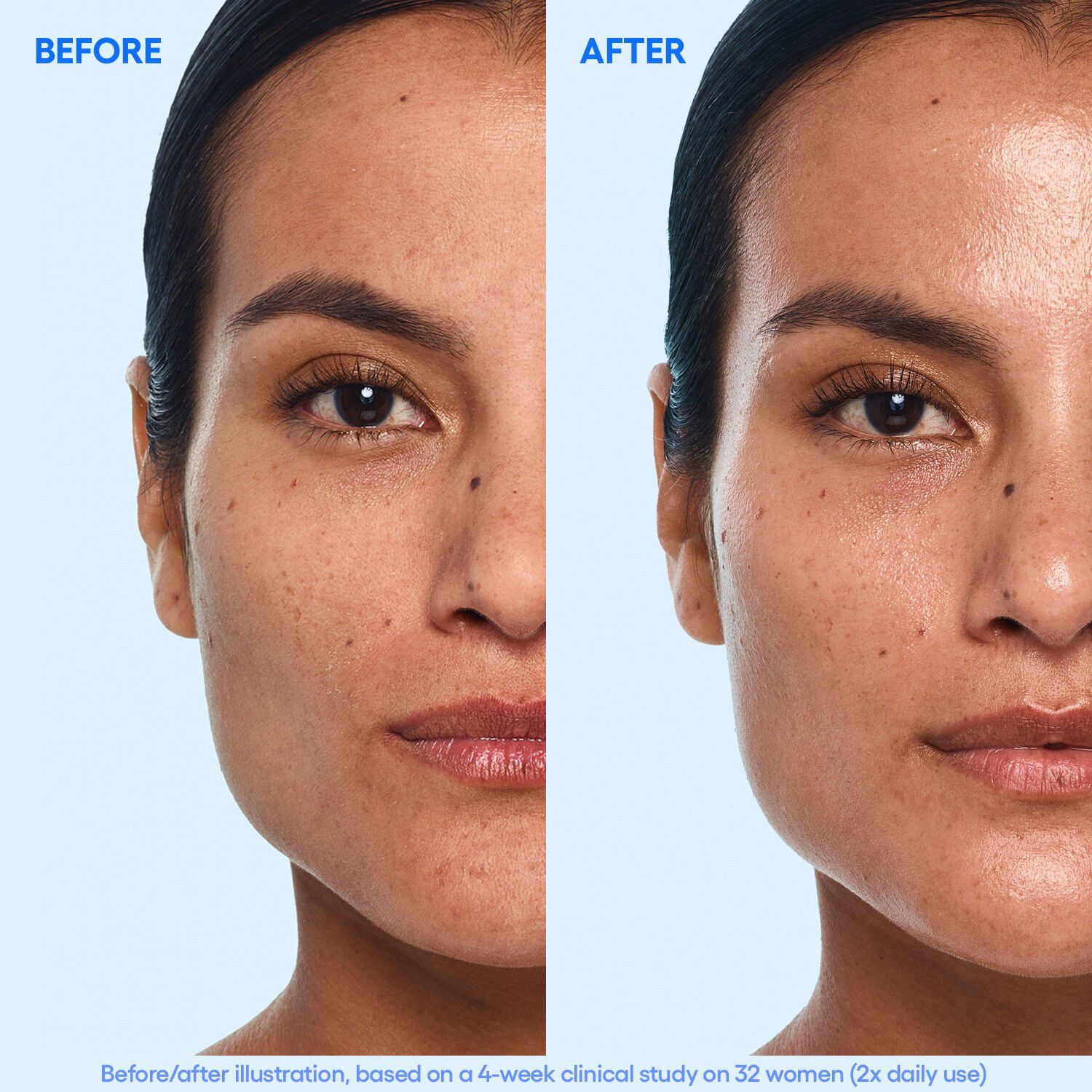 Water Bank Aqua Facial - Fugtgivende serum med udstr&aring;ling og AHA/BHA