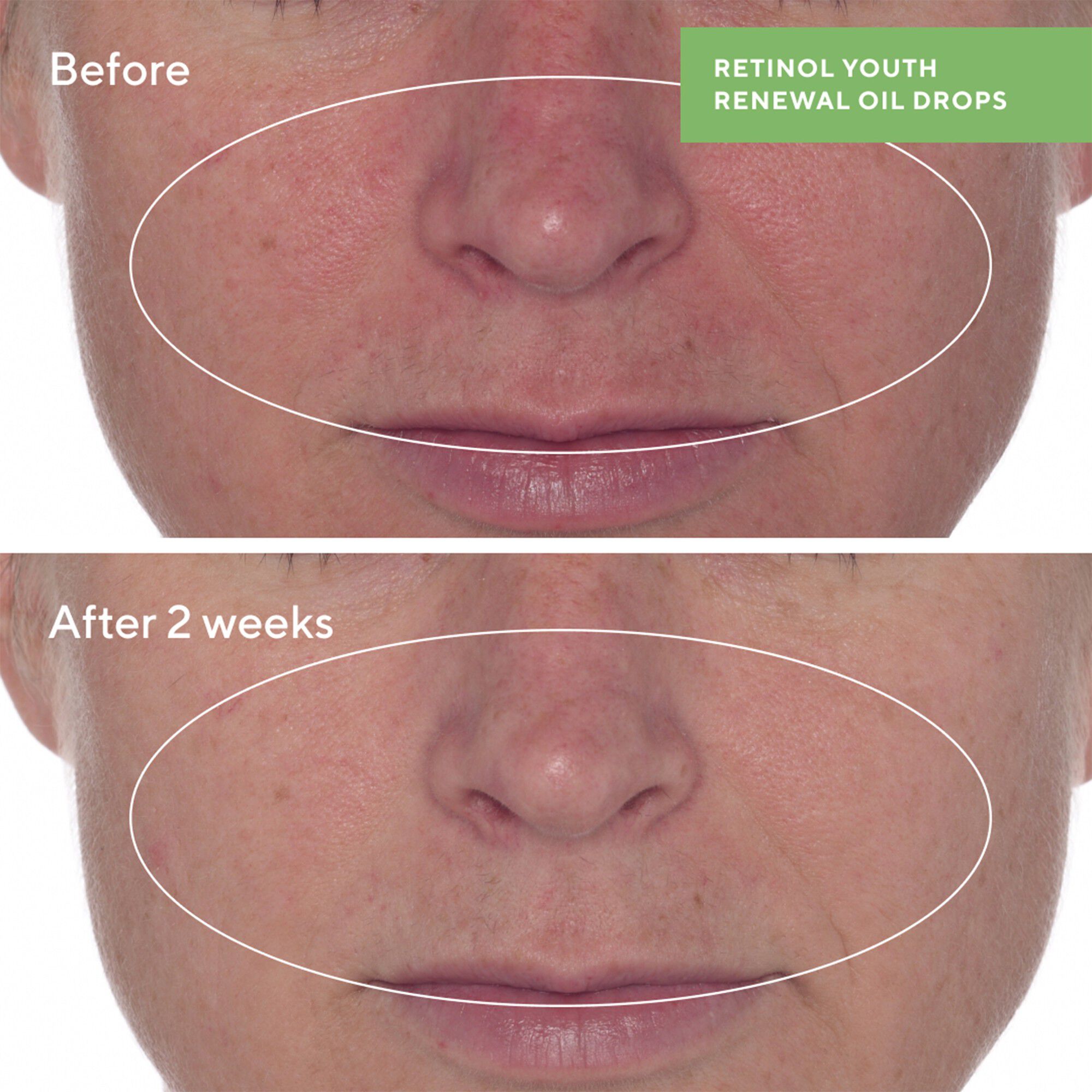 RETINOL YOUTH RENEWAL OIL DROPS 30 ML