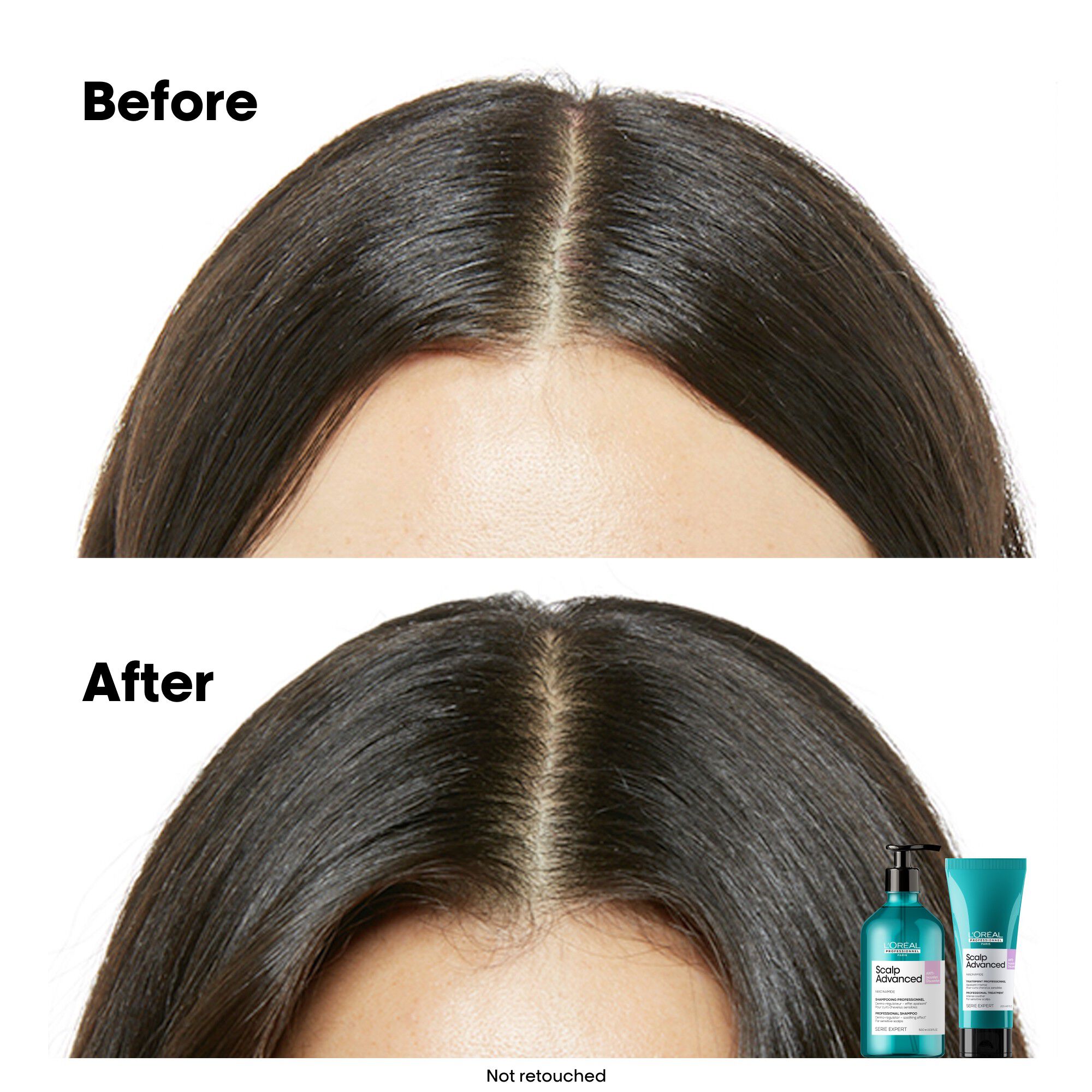 L'Or&eacute;al Professionnel Scalp Advanced Anti-Discomfort Shampoo 500ml