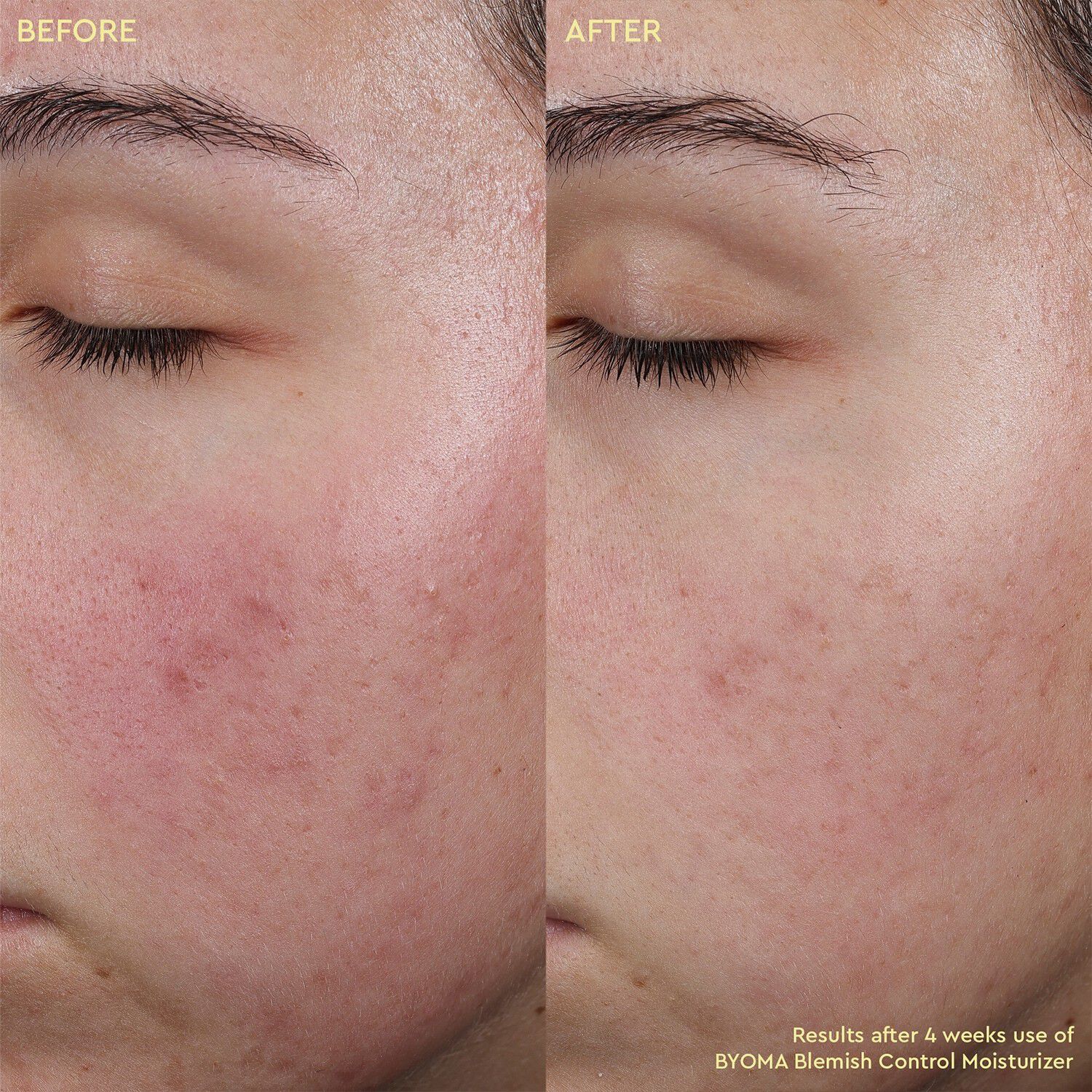 Blemish Control Moisturizer - Fugtighedscreme mod urenheder