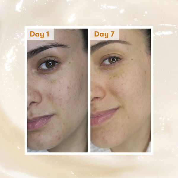 Radiance Overnight Dark Spot Sleeping Cream