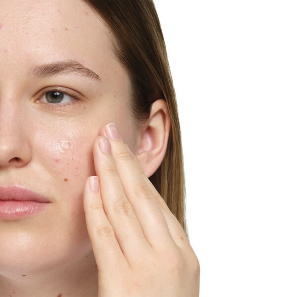 Salicylic Acid 2% Anhydrous Solution