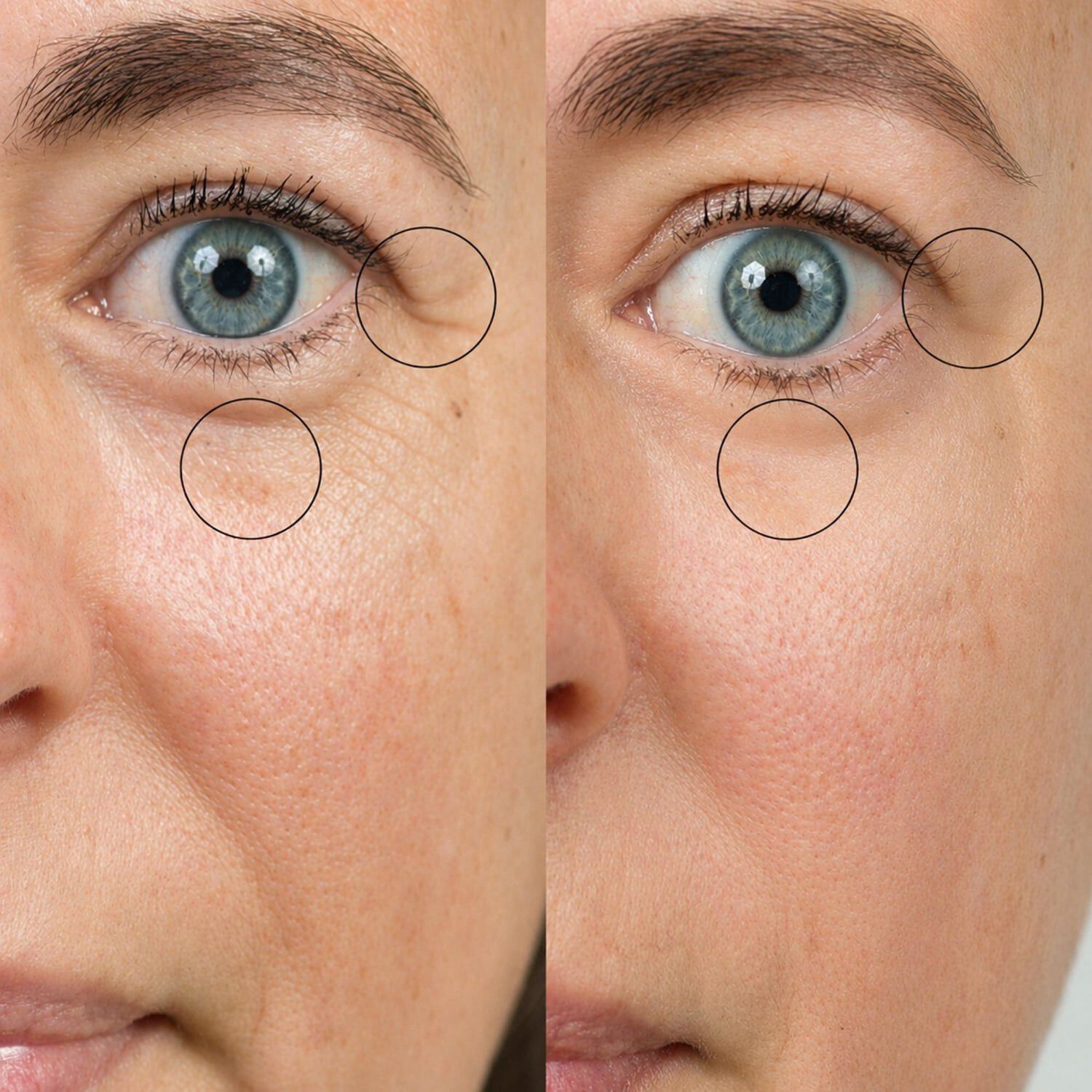 Bio-active Ceramide Eye Cream - &Oslash;jencreme med bioaktive ceramider