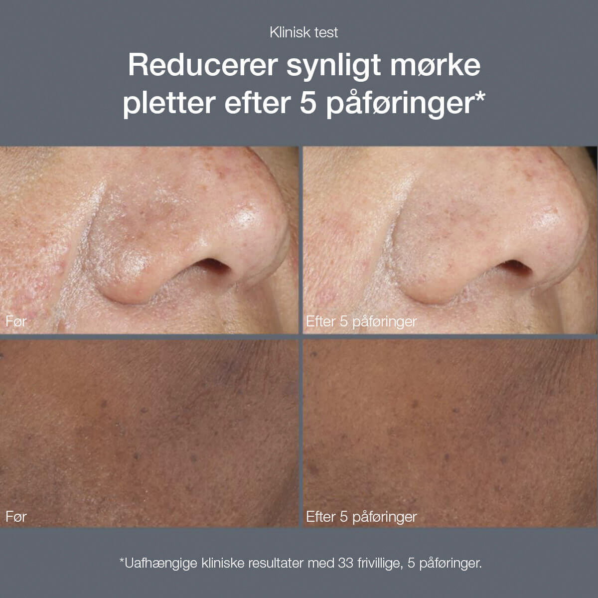 Powerbright Dark Spot Peel 50ml