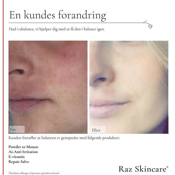 Raz Skincare Repair Salve 15 ml