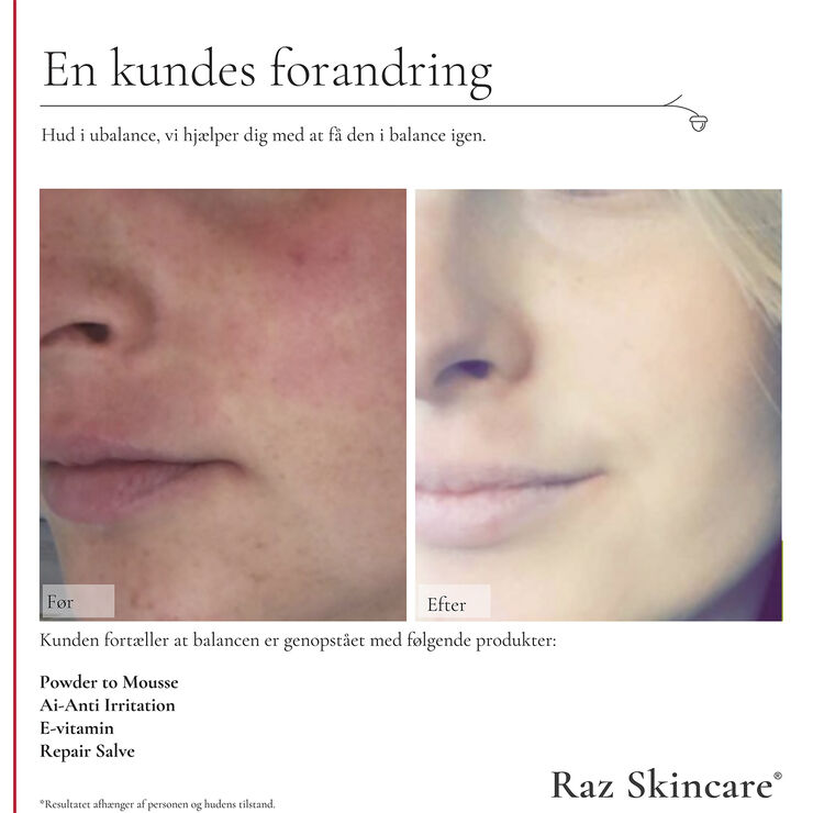 Raz Skincare Repair Salve 15 ml