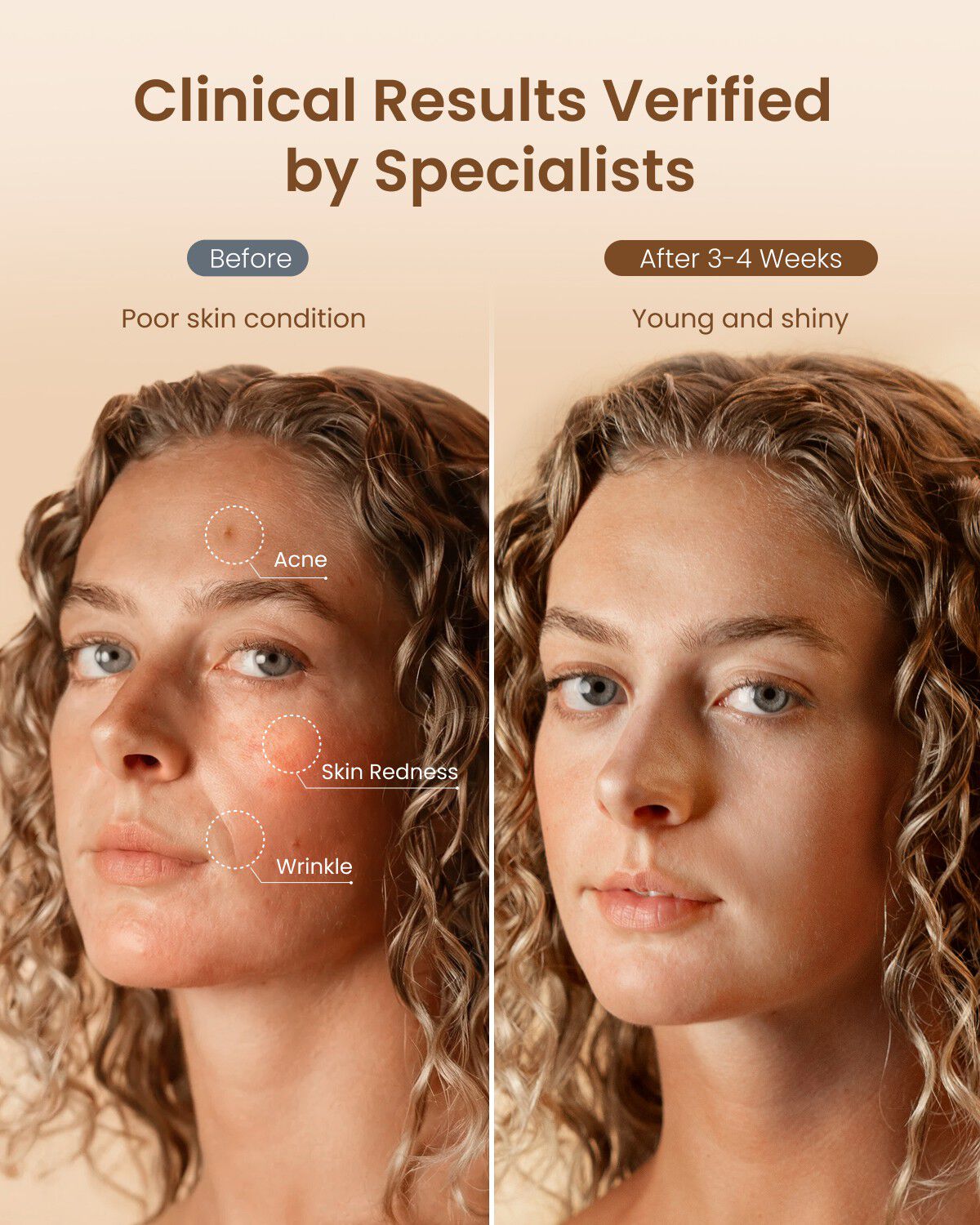 ARTIMIS - LED Light Soft Mask 324 LED