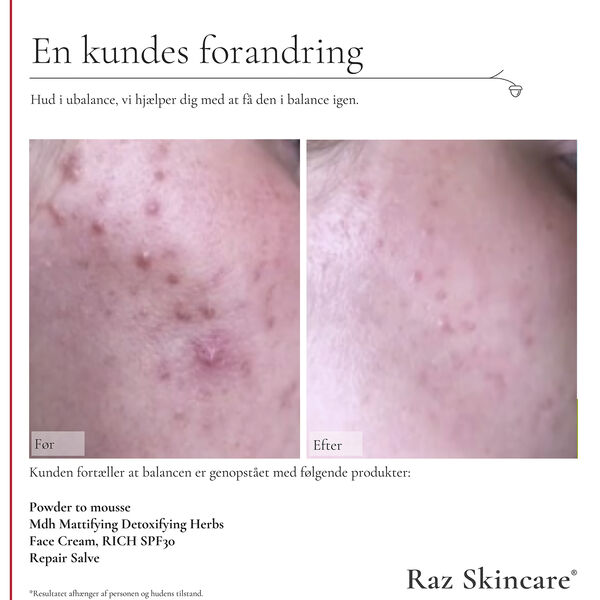 Raz Skincare Powder to Mousse 50 g